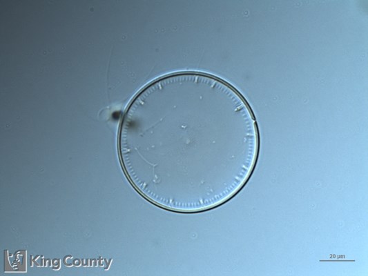 Photo of Thalassiosira punctigera
